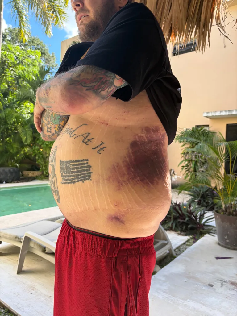 &lsquo;Pawn Stars&rsquo; star Corey Harrison begs fans for help paying motorcycle accident bills