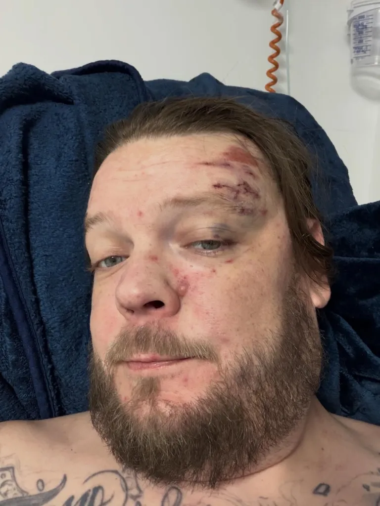 &lsquo;Pawn Stars&rsquo; star Corey Harrison begs fans for help paying motorcycle accident bills