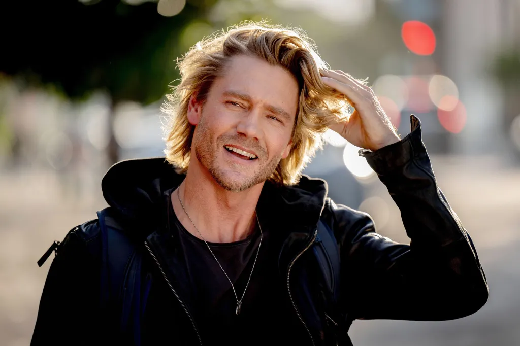 Chad Michael Murray fans stunned by &lsquo;unrecognizable&rsquo; photo of actor before nose injury transformed his face
