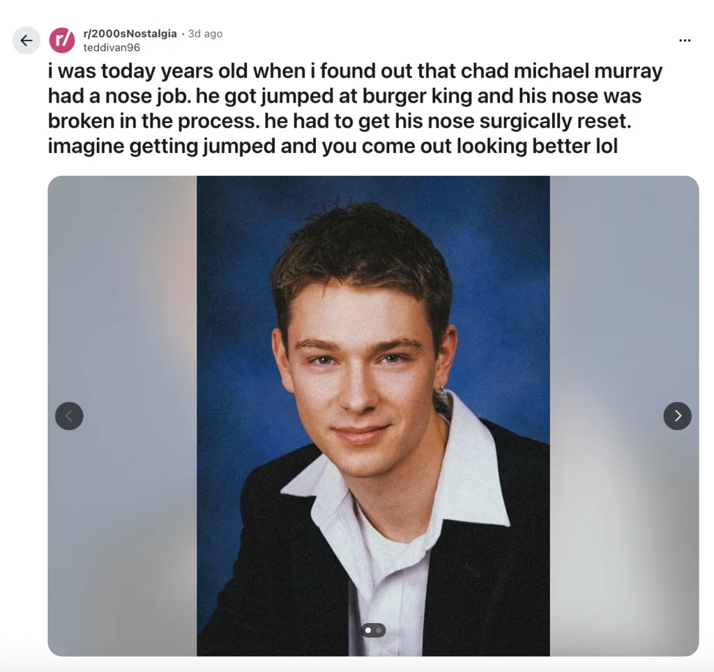 Chad Michael Murray fans stunned by &lsquo;unrecognizable&rsquo; photo of actor before nose injury transformed his face